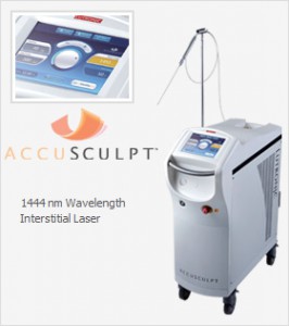 accusculpt 266x300